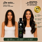 Champú Crecimiento Acelerado – Fuerza, Volumen y Cuidado Capilar (300 ml)