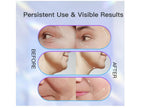 Masajeador facial lifting EMS